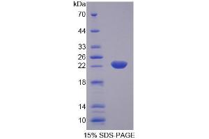 SDS-PAGE analysis of Rat KTN1 Protein. (KTN1 Protein)