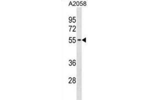 Western Blotting (WB) image for anti-Thioredoxin-Related Transmembrane Protein 3 (TMX3) antibody (ABIN3001033) (TMX3 Antikörper)