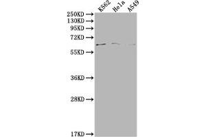 Western Blot Positive WB detected in: K562 whole cell lysate, Hela whole cell lysate, A549 whole cell lysate All lanes: MAP3K7 antibody at 1:500 Secondary Goat polyclonal to rabbit IgG at 1/50000 dilution Predicted band size: 68, 65, 57, 54 kDa Observed band size: 68 kDa (MAP3K7 Antikörper  (AA 179-194))