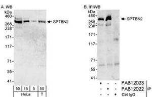 Western blot analysis of SPTBN2 in HeLa whole cell lysate (5, 15 and 50 ug for WB; 1 mg for IP, 20% of IP loaded) and HEK 293T (Bosc 23) (T : 50 ug) cells with SPTBN2 polyclonal antibody . (Spectrin, Beta, Non-erythrocytic 2 (SPTBN2) (C-Term) Antikörper)
