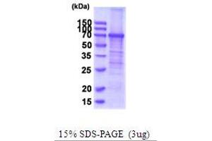 SDS-PAGE (SDS) image for Transferrin Receptor (p90, CD71) (TFRC) (AA 89-760) protein (His tag) (ABIN5854102) (Transferrin Receptor Protein (AA 89-760) (His tag))