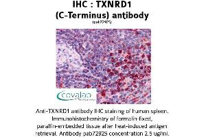 Image no. 1 for anti-Thioredoxin Reductase 1 (TXNRD1) (C-Term) antibody (ABIN1740489) (TXNRD1 Antikörper  (C-Term))