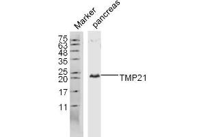 Lane 1: Mouse pancreas lysates probed with TMP21 Polyclonal Antibody, Unconjugated  at 1:300 overnight at 4˚C. (TMED10 Antikörper  (AA 101-200))