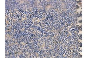 ABIN6260744 and ABIN6272626 at 1/100 staining human normal tonsil tissue by IHC-P.