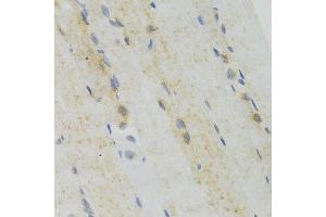 Immunohistochemistry of paraffin-embedded mouse skeletal muscle using GEMIN2 Antibody. (SIP1 Antikörper)