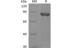 Western Blotting (WB) image for Growth Arrest-Specific 6 (GAS6) (Active) protein (His tag) (ABIN7319834) (GAS6 Protein (His tag))
