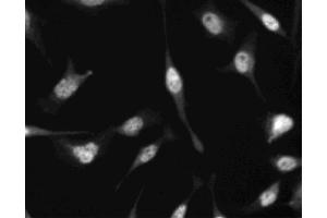 Immunofluorescent staining of HeLa (ATCC CCL-2) cells. (CDKN1B Antikörper)