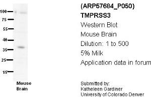 Image no. 3 for anti-Transmembrane Protease, Serine 3 (TMPRSS3) (N-Term) antibody (ABIN2787338)