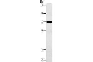 Gel: 6 % SDS-PAGE, Lysate: 40 μg, Lane: Mouse heart tissue, Primary antibody: ABIN7191964(POU6F2 Antibody) at dilution 1/200, Secondary antibody: Goat anti rabbit IgG at 1/8000 dilution, Exposure time: 30 seconds (POU6F2 Antikörper)