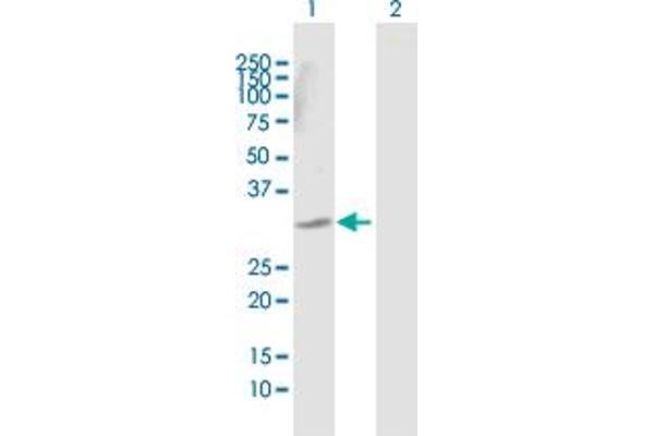 DECR2 Antikörper  (AA 1-292)