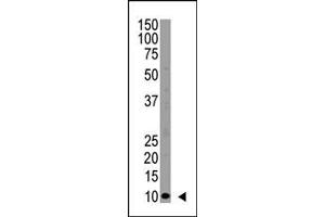 Image no. 1 for anti-Ubiquitin (Ub) (N-Term) antibody (ABIN356746)