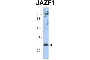 Host:  Rabbit  Target Name:  JAZF1  Sample Type:  Jurkat  Antibody Dilution:  1.
