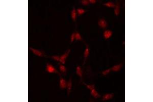 ABIN6267512 staining 293 by IF/ICC. (STAT5A Antikörper  (pSer780))