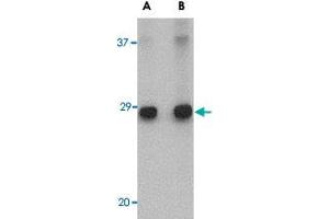 Western blot analysis of ELOVL6 in human brain tissue lysate with ELOVL6 polyclonal antibody  at (A) 1 and (B) 2 ug/mL . (ELOVL6 Antikörper  (C-Term))