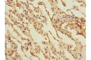 Immunohistochemistry of paraffin-embedded human lung tissue using ABIN7158886 at dilution of 1:100 (MARCO Antikörper  (AA 421-520))