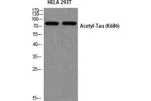 Western blot analysis of HELA 293T using Acetyl-Tau (K686) antibody.