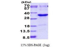 JAZF1 Protein (AA 1-243) (His tag)