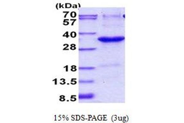 JAZF1 Protein (AA 1-243) (His tag)