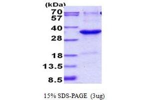 SDS-PAGE (SDS) image for JAZF Zinc Finger 1 (JAZF1) (AA 1-243) protein (His tag) (ABIN5852948) (JAZF1 Protein (AA 1-243) (His tag))