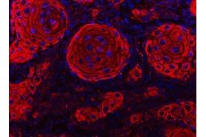 IF analysis of Cytokeratin 2e/KRT2 using anti-Cytokeratin 2e/KRT2 antibody (ABIN7600644). (Keratin 2 Antikörper  (AA 213-332))