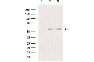 CDKL2 Antikörper  (Internal Region)