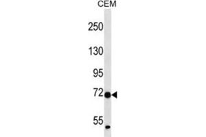 Western Blotting (WB) image for anti-Zinc Finger Protein 443 (ZNF443) antibody (ABIN2997281) (ZNF443 Antikörper)