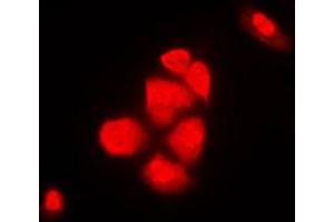 Immunofluorescent analysis of XPO2 staining in NIH3T3 cells. (Exportin 2 Antikörper  (N-Term))