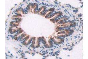 Figure. (OAS1 Antikörper  (AA 139-358))