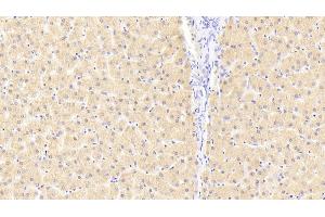 Detection of FKBPL in Human Liver Tissue using Polyclonal Antibody to FK506 Binding Protein Like Protein (FKBPL) (FKBPL Antikörper  (AA 1-349))