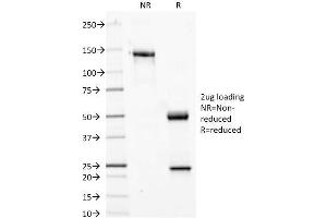 SDS-PAGE Analysis Purified Phosphotyrosine Mouse Monoclonal Antibody (PY20). (Phosphotyrosine Antikörper)