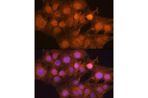 Immunofluorescence analysis of C6 cells using MDM2 antibody (ABIN6133186, ABIN6143671, ABIN6143672 and ABIN6217278) at dilution of 1:100. (MDM2 Antikörper  (AA 200-430))