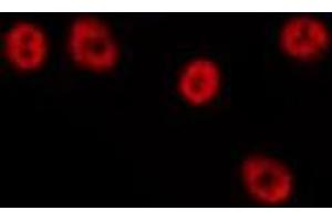 ABIN6275692 staining HepG2 by IF/ICC. (ZNF460 Antikörper  (C-Term))