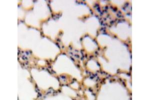 IHC-P analysis of Lung tissue, with DAB staining. (Calmodulin 1 Antikörper  (AA 2-149))