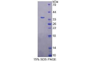SDS-PAGE (SDS) image for Kell Blood Group, Metallo-Endopeptidase (KEL) (AA 439-713) protein (His tag) (ABIN6238790) (KEL Protein (AA 439-713) (His tag))