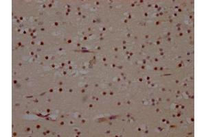 IHC image of ABIN7127654 diluted at 1:100 and staining in paraffin-embedded human brain tissue performed on a Leica BondTM system.