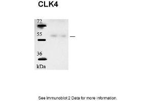 Sample type: human microvascular endothelial cells (25ug)Primary Dilution: 1:1000Secondary Antibody: Goat anti-Rabbit-HRPSecondary Dilution: 1:5000Image Submitted by: Andreas Eisenreich Charite Universitatsmedizin Berlin (CLK4 Antikörper  (N-Term))