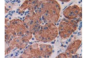 Immunohistochemistry (IHC) image for anti-Interleukin-1 Receptor-Associated Kinase 1 (IRAK1) (AA 212-440) antibody (ABIN1859466)