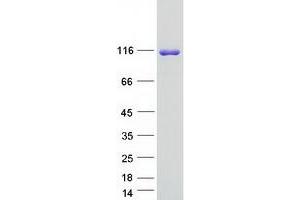Western Blotting (WB) image for SH3 and PX Domains 2B (SH3PXD2B) protein (Myc-DYKDDDDK Tag) (ABIN2731965)