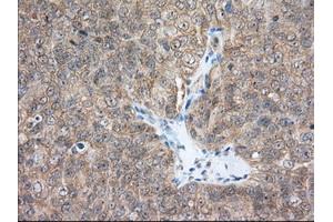 Immunohistochemical staining of paraffin-embedded Human Kidney tissue using anti-ACAT2 mouse monoclonal antibody. (ACAT2 Antikörper)