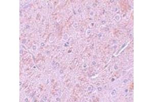 Immunohistochemistry (IHC) image for anti-Protein Inhibitor of Activated STAT, 2 (PIAS2) (N-Term) antibody (ABIN1031511) (PIAS2 Antikörper  (N-Term))