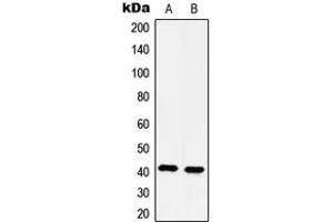 Western blot analysis of 5-HT4 expression in HeLa (A), Jurkat (B) whole cell lysates. (Serotonin Receptor 4 Antikörper  (N-Term))