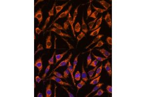 Immunofluorescence analysis of L929 cells using SNX15 antibody  at dilution of 1:100. (SNX15 Antikörper  (AA 1-342))