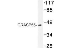 Image no. 1 for anti-Golgi Reassembly Stacking Protein 2, 55kDa (GORASP2) antibody (ABIN317911) (GORASP2 Antikörper)