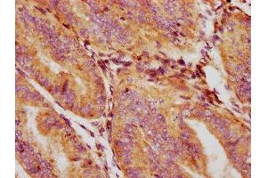 Immunohistochemistry (IHC) image for anti-Growth Differentiation Factor 5 (GDF5) (AA 202-501) antibody (ABIN7154549)
