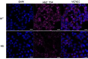 Immunocytochemical staining of HeLa cells using HSD17B4 antibody (ABIN7799015), 1:1,000), Top panel: wild-type (WT), Bottom panal: HSD17B4 shRNA knockdown (KD). (HSD17B4 Antikörper)