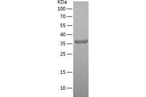 Western Blotting (WB) image for SLIT and NTRK-Like Family, Member 6 (SLITRK6) (AA 630-841) protein (His tag) (ABIN7282574) (SLITRK6 Protein (AA 630-841) (His tag))