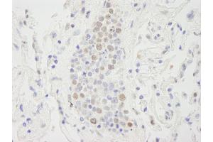 Immunohistochemistry (IHC) image for anti-Suppressor of Ty 6 Homolog (SUPT6H) (AA 425-475) antibody (ABIN7448820)