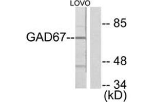 Western blot analysis of extracts from LOVO cells, using GAD1 Antibody.