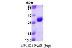 SDS-PAGE (SDS) image for Proteasome Subunit Alpha Type 3 (PSMA3) (AA 1-255) protein (His tag) (ABIN666620) (PSMA3 Protein (AA 1-255) (His tag))