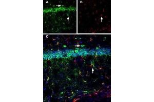 Expression of Calnexin in mouse hippocampusImmunohistochemical staining of mouse hippocampal CA1 region using Anti-Calnexin Antibody (ABIN7043021, ABIN7044212 and ABIN7044213), (1:200). (Calnexin (CANX) Peptid)